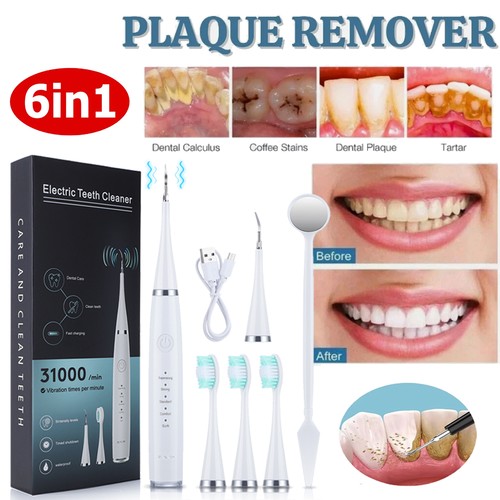 Electric dental scaler - electric,