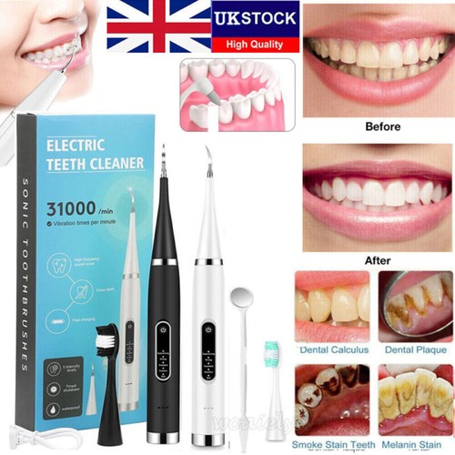 Electric ultrasonic tooth - electric,