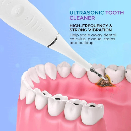 Electric plaque remover for - electric,