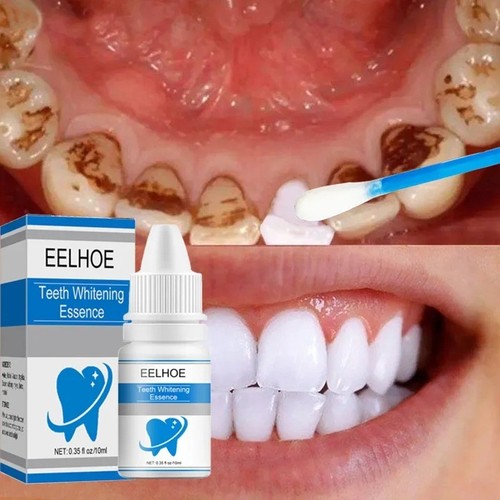 Teeth whitening essence remove - teeth,